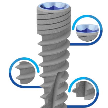 Bioline Spiral (SPI) Implant